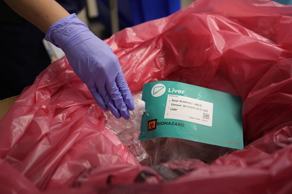 Les dons d'organes ont augmenté chez les prestataires de l'aide médicale à mourir