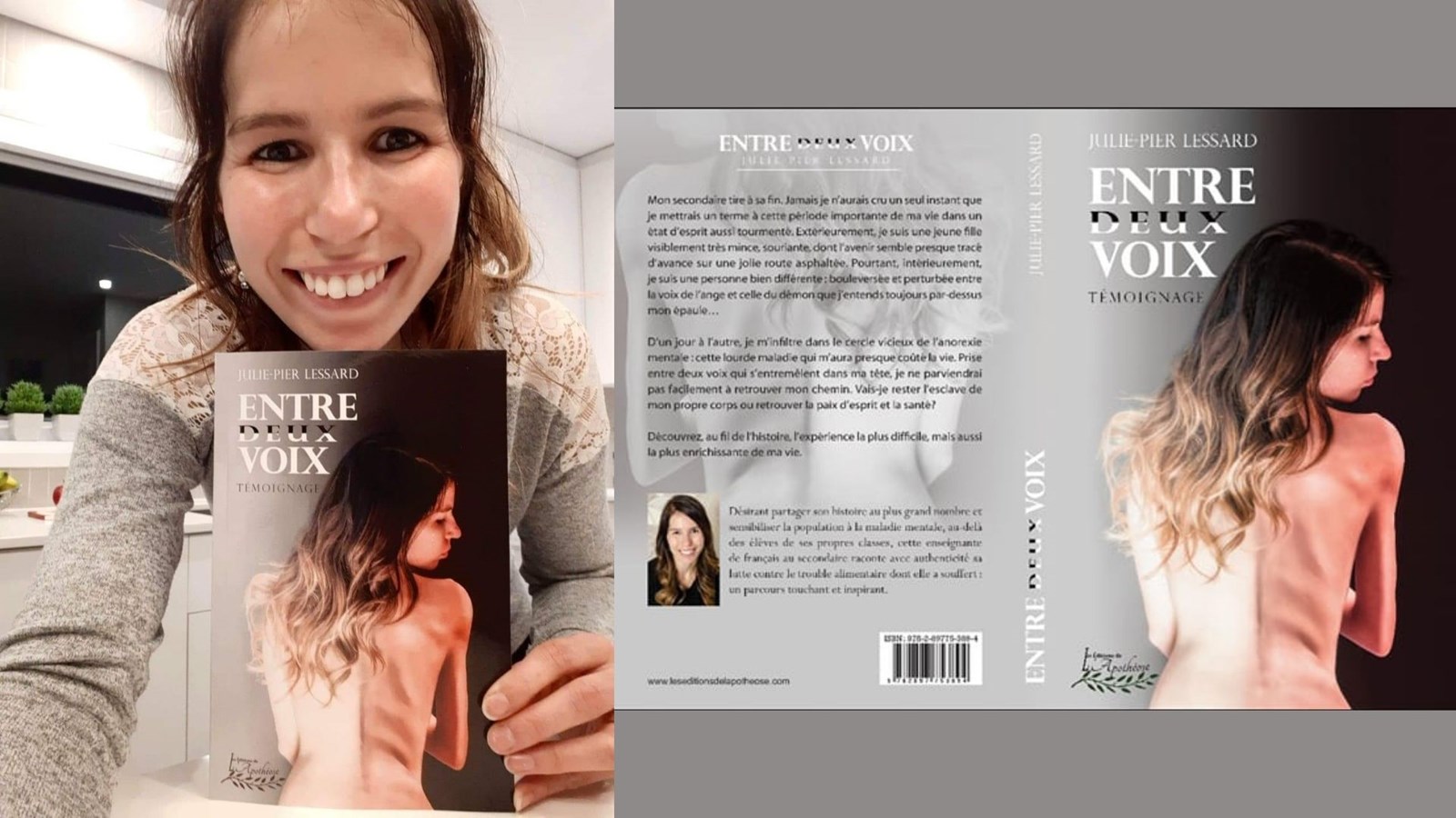 Julie-Pier Lessard raconte son combat contre l'anorexie