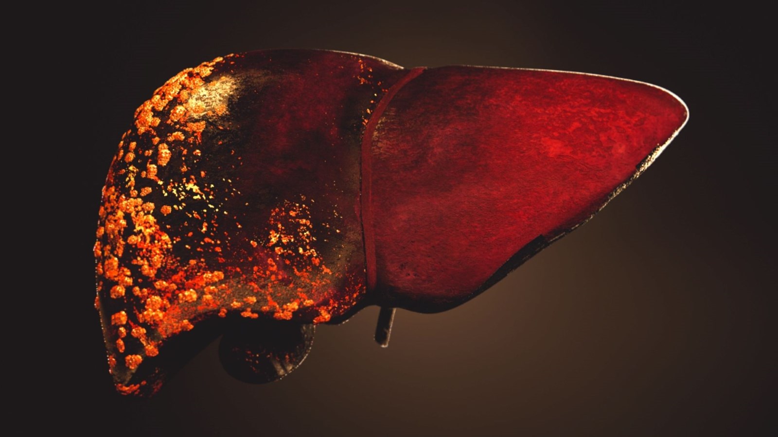 Le tabac cause cinq types de cancer digestifs 