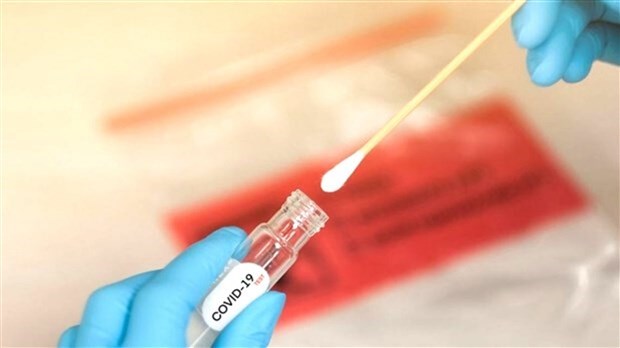 COVID-19 : augmentation importante du nombre d'hospitalisations