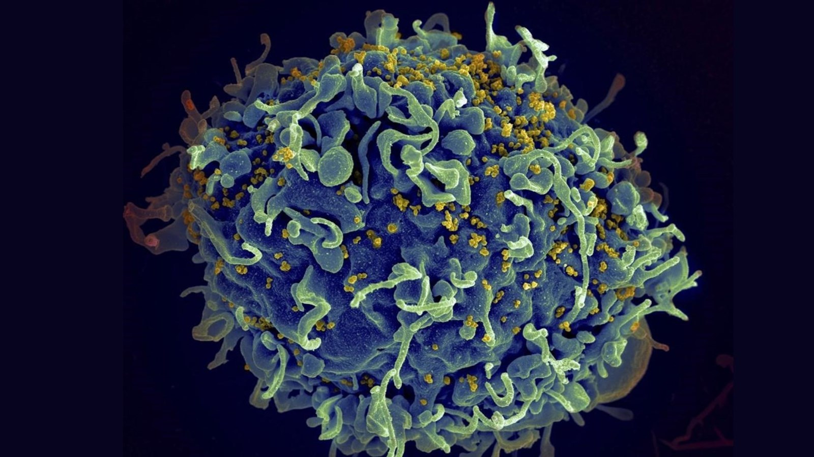 Les changements climatiques pourraient augmenter le risque de nouvelles infections